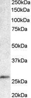 NB100-769 - Bcl-7A