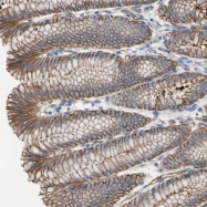 NBP1-90315 - Trophoblast glycoprotein (TPBG)