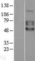 NBL1-17210 - 5T4 Lysate