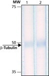 NB600-1514 - TUBB / TUBB5