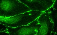 NB600-344 - DYKDDDDK Epitope Tag