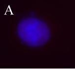 NB100-78566 - Aurora kinase B