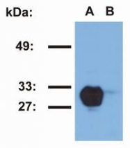 NB500-579 - HLA class II DR beta 1 / HLA-DRB1