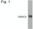 NB100-74561 - VDAC-3