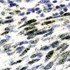 NBP1-22767 - Herpes Virus Type 8 / HHV8