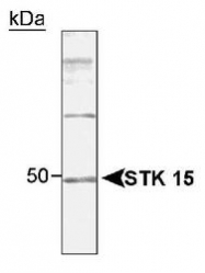 NB100-917 - Aurora kinase A