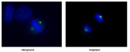 NB100-917 - Aurora kinase A
