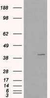 NB100-1386 - VPS26A
