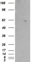 NB100-1467 - RXR-beta / RXRB