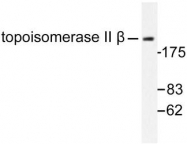 NB100-92111 - TOP2B