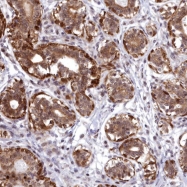 NBP1-91643 - ABCB8 / MABC1
