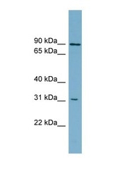 NBP1-59808 - ABCD2 / ALDR
