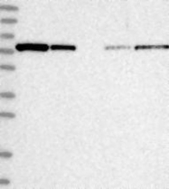 NBP1-84781 - ABCF3
