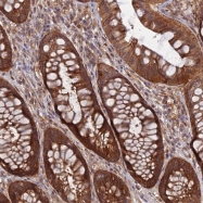 NBP1-91644 - ABHD1