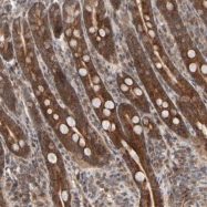 NBP1-87254 - ABHD11