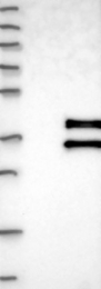 NBP1-87254 - ABHD11