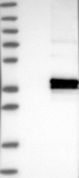 NBP1-88978 - ABHD13