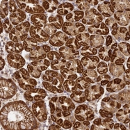 NBP1-84147 - ABHD14A