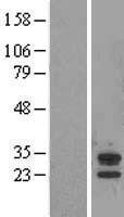 NBL1-07193 - ABHD14A Lysate