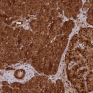 NBP1-84472 - ABHD14B