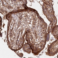 NBP1-84473 - ABHD14B
