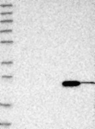 NBP1-84472 - ABHD14B