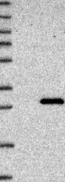 NBP1-84473 - ABHD14B