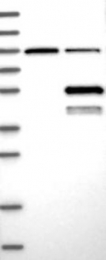 NBP1-82850 - ABHD2 / LABH2