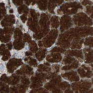 NBP1-82850 - ABHD2 / LABH2