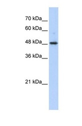 NBP1-53199 - ABHD2 / LABH2