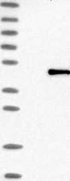 NBP1-83711 - ABHD4