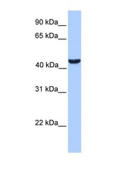 NBP1-55457 - ABHD5