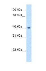 NBP1-55458 - ABHD5