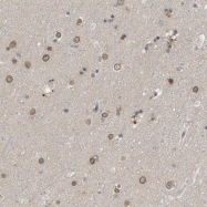 NBP1-86058 - ABHD6