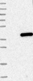 NBP1-86058 - ABHD6
