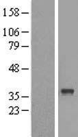 NBL1-07200 - ABHD6 Lysate