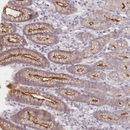 NBP1-83728 - ABHD8