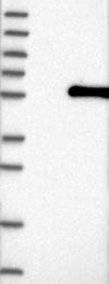 NBP1-83728 - ABHD8