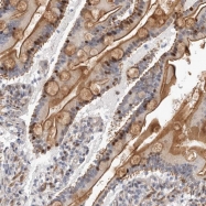 NBP1-90290 - ABHD9