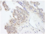 NB100-59845 - ABI1 / SSH3BP1