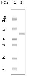 NBP1-47370 - ABL2