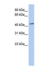 NBP1-55156 - ACAA1