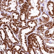 NBP1-84974 - ACAA2