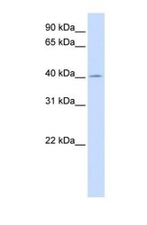 NBP1-54746 - ACAA2