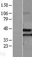 NBL1-07217 - ACAA2 Lysate