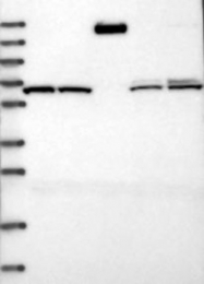 NBP1-82749 - ACAD9