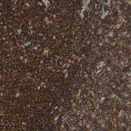 NBP1-89288 - ACADL