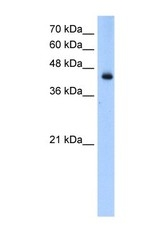 NBP1-54936 - ACADL