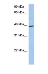 NBP1-54729 - ACADM