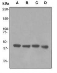 NBP1-95262 - ACADM